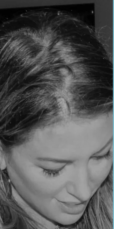 Before - Ayesha