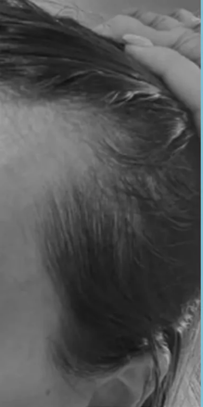 Before - Zoya Ahmed